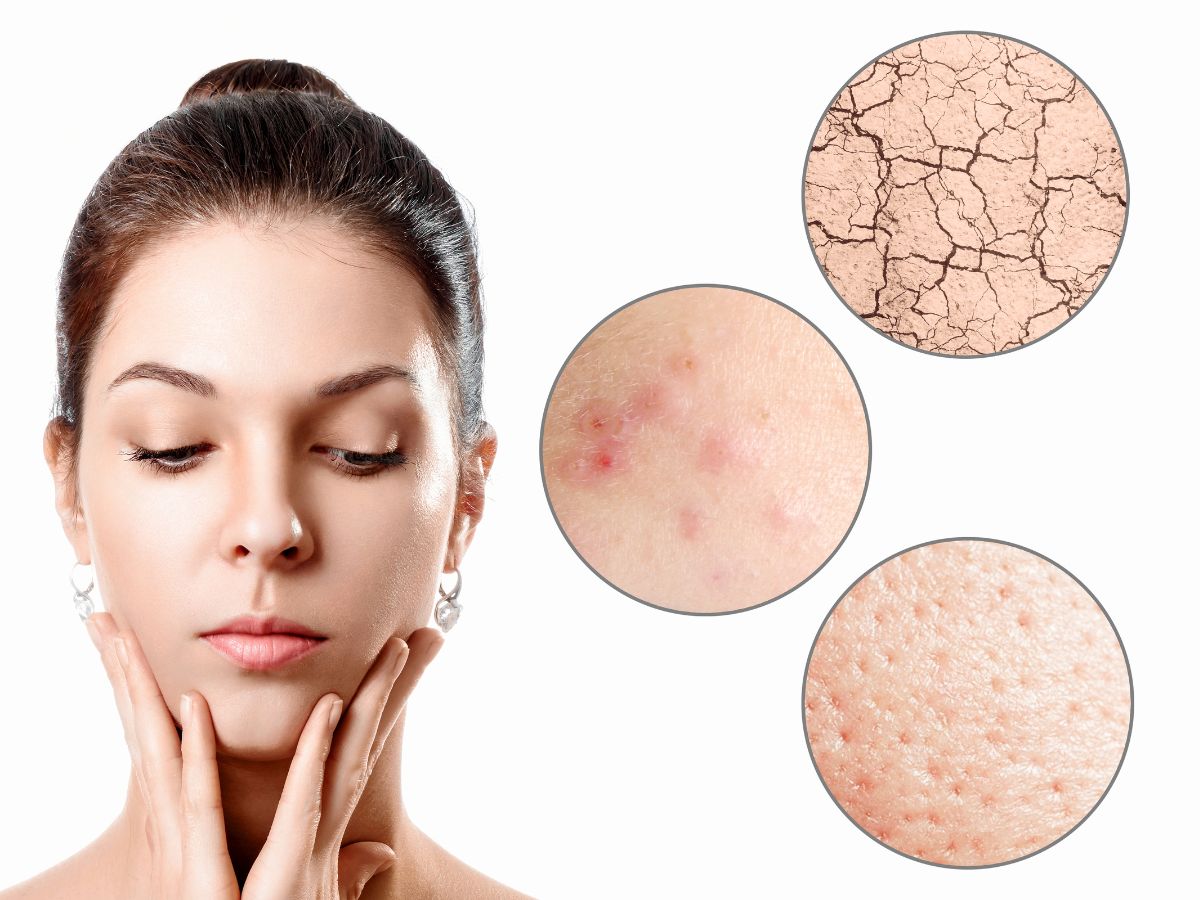 How to Choose the Best Moisturizer for Dry Skin Your Ultimate Guide